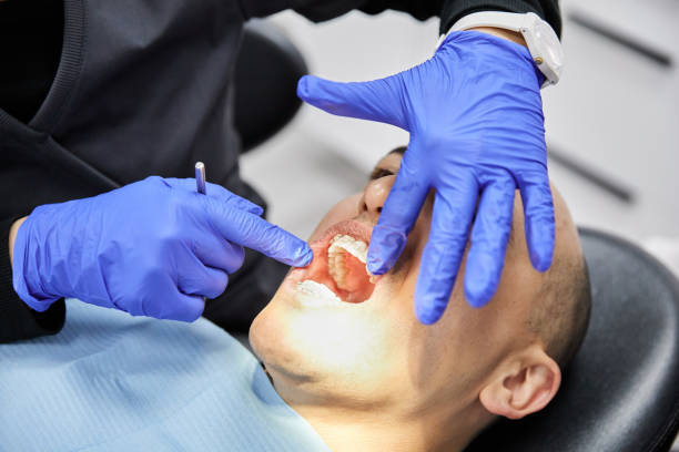 Best Emergency Cosmetic Dentistry (e.g., broken veneers) in Summit View, WA